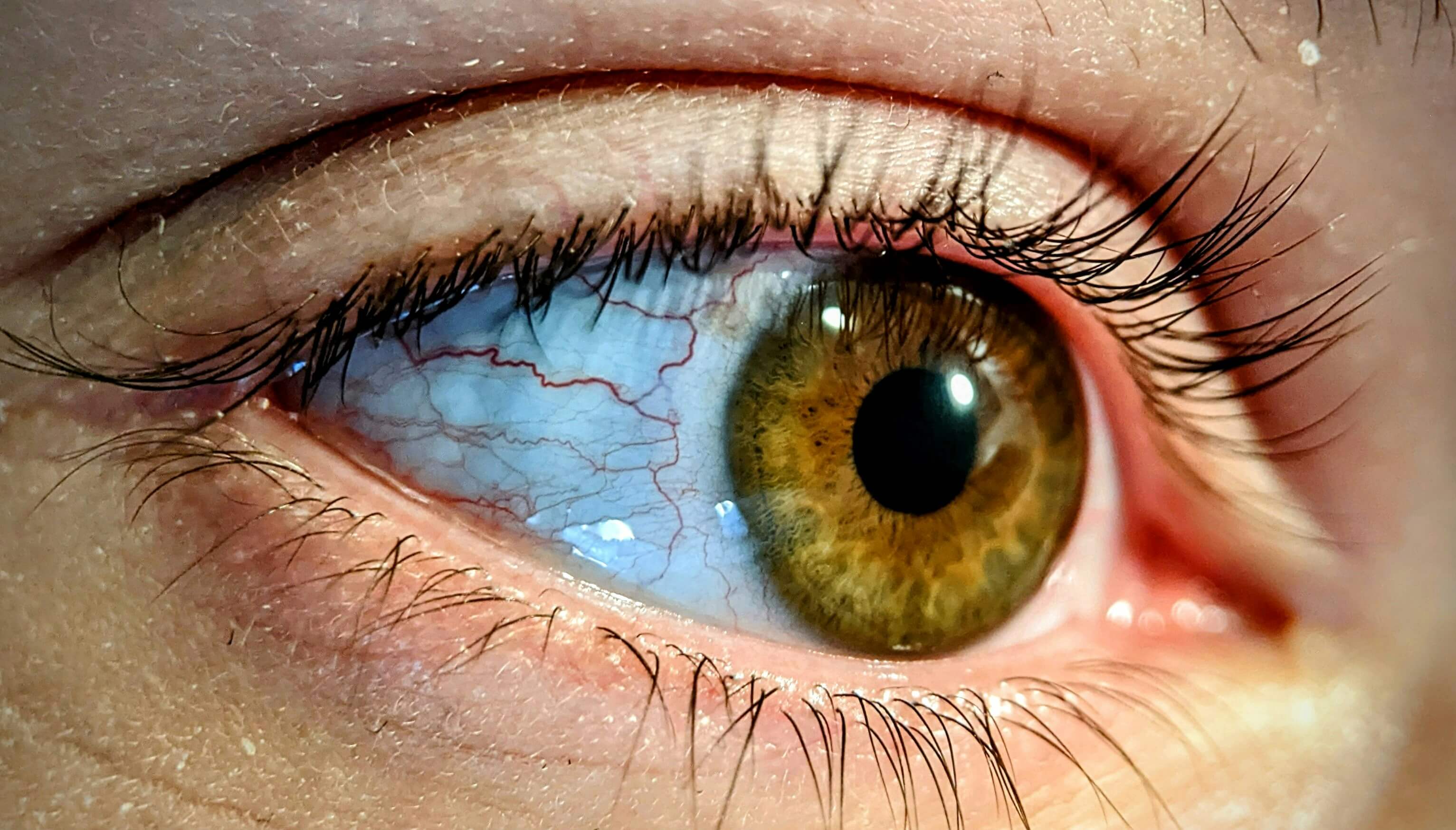 eye
